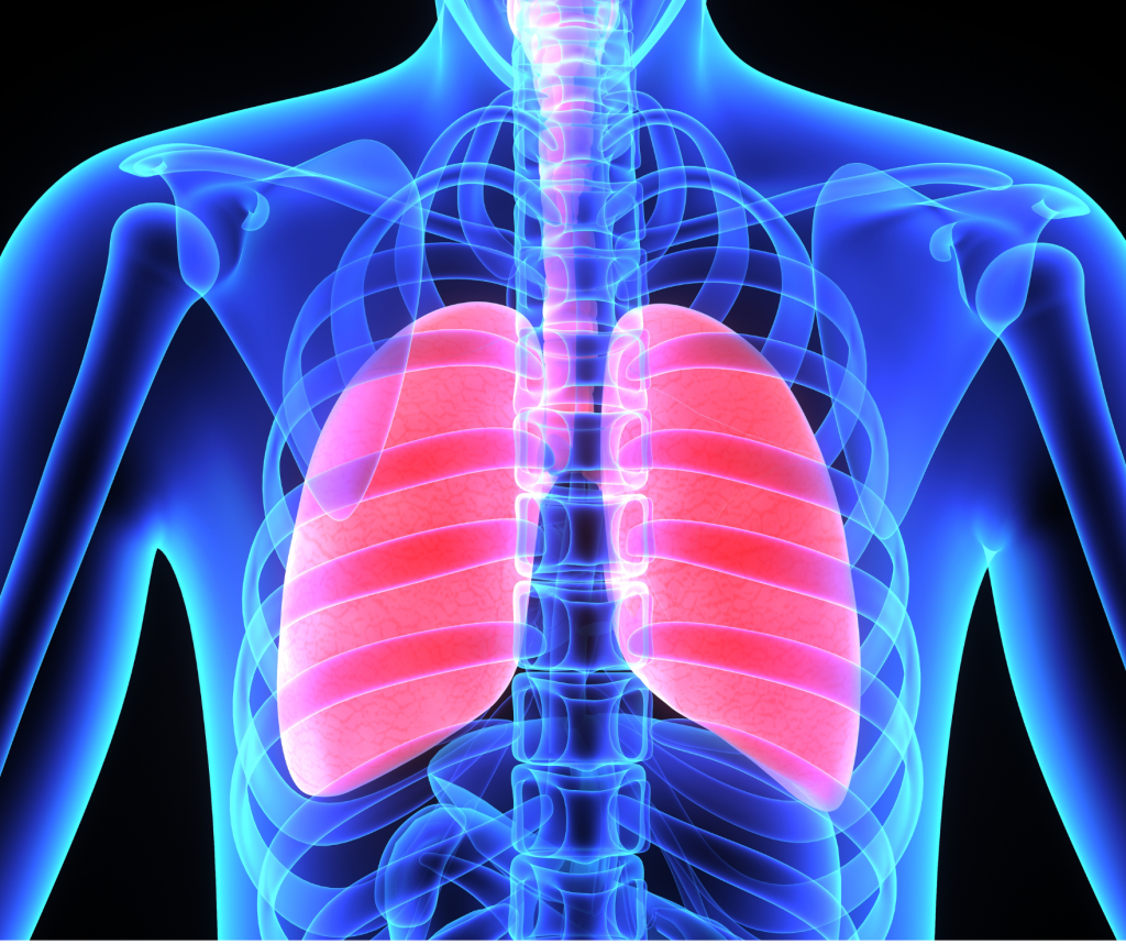 Pľúcna fibróza - ako sa diagnostikuje a ako lieči?