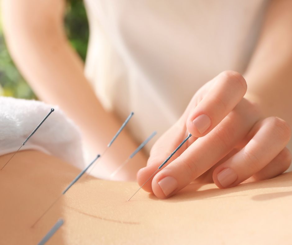 V tradičnej čínskej medicíne, z ktorej vychádza aj akupunktúra, sa verí, že v tele existuje sieť meridiánov alebo dráh, ktoré slúžia na prenos energie, známej ako qi alebo čchi. 