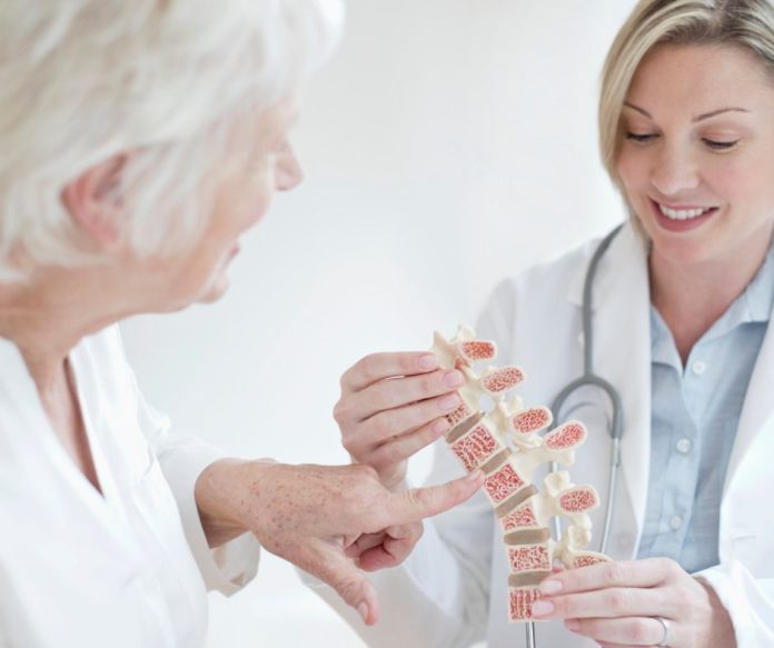 Osteoporóza - aké sú najčastejšie mýty okolo tohto ochorenia?