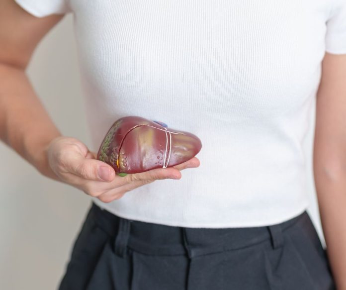 Nealkoholové stukovatenie pečene. Detoxikácia pečene by mala byť súčasťou celkového zdravého životného štýlu, ktorý zahŕňa zdravú stravu a dostatočnú pohybovú aktivitu.