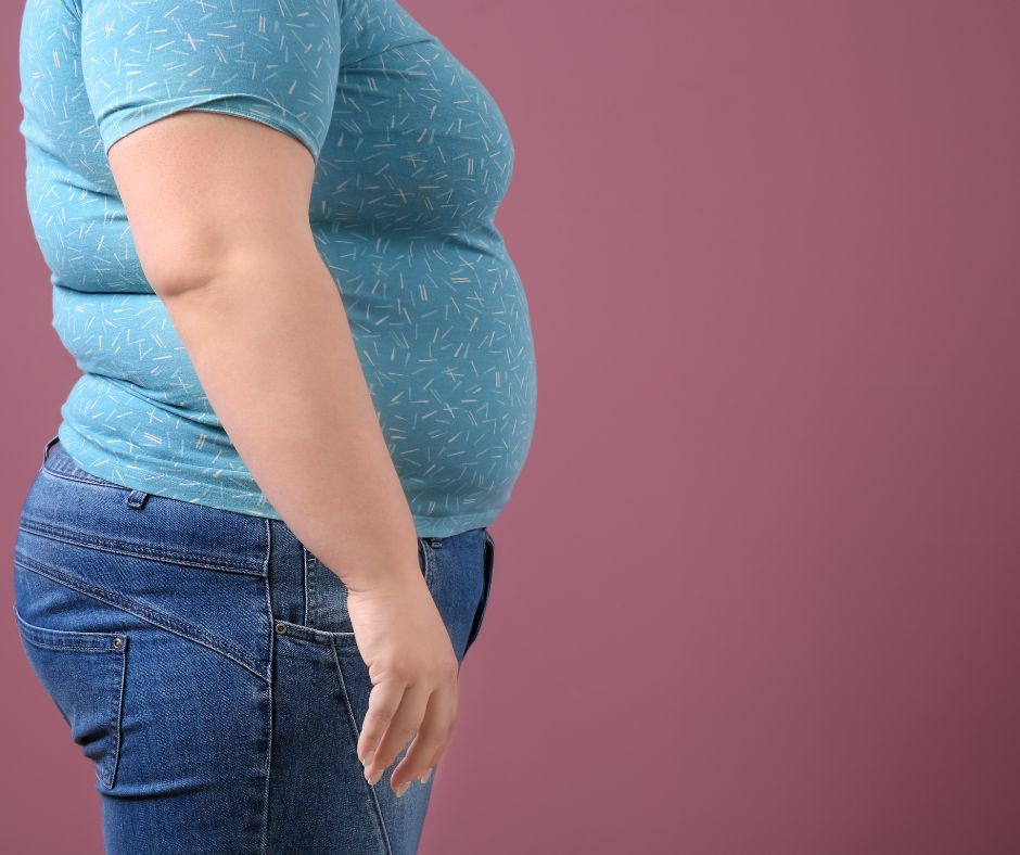 Liečba obezity by mala byť individuálne prispôsobená 