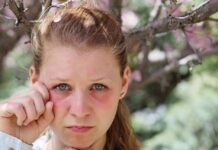 Vedeli ste, že ľudia s alergiou na peľ majú dvakrát až trikrát vyššiu pravdepodobnosť výskytu potravinových reakcií? Môže za to fenomén známy ako skrížená alergia